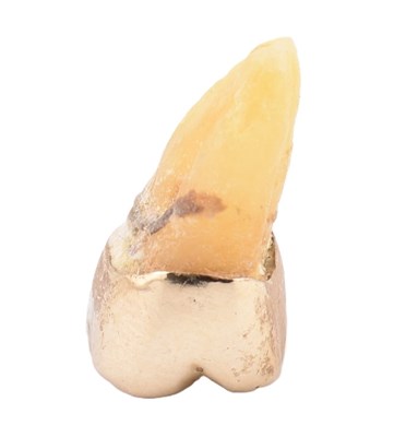 Lot 276 - GOLD CROWN AFFIXED TO TOOTH