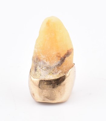 Lot 276 - GOLD CROWN AFFIXED TO TOOTH