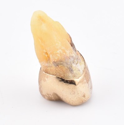Lot 276 - GOLD CROWN AFFIXED TO TOOTH